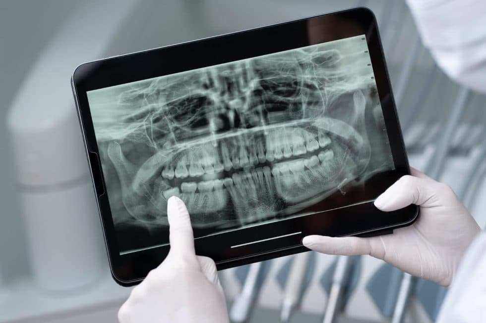 Clínica dental de proximidad en Madrid: ventajas de confiar en un dentista cerca de ti