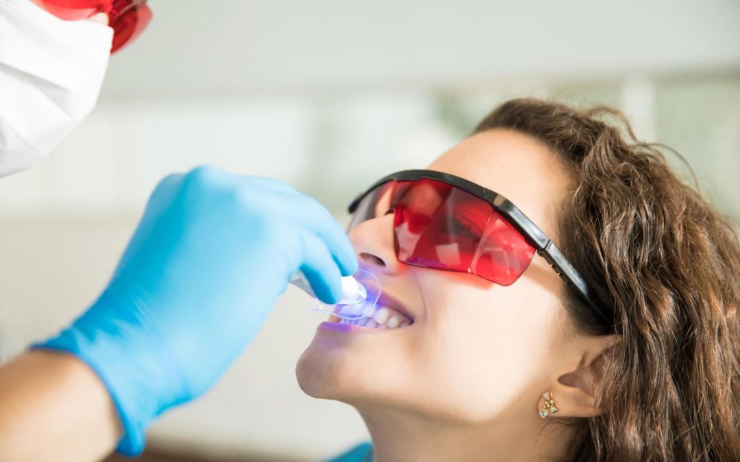 Blanqueamiento dental profesional: cómo lucir una sonrisa radiante esta primavera